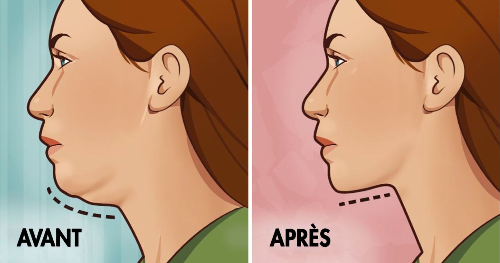 double menton exercice